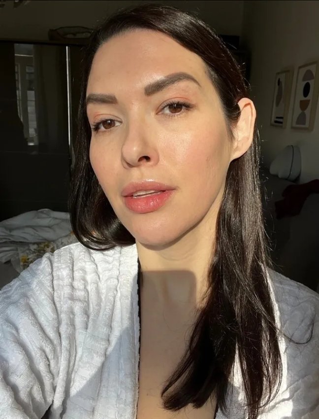 How I Cleared My Acne with Bioptron Light Therapy
